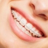 Smiles HQ | Clairemont Mesa Dentist
